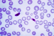 Gametocyte
