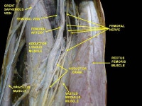 파일:Slide4888.JPG - Wikiwand Wikiwand - 파일:Slide4888.JPG