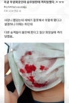 메이플스토리 인벤 : 사랑니 뽑고 기차타다 격리 당함.jpg - 메이플스토리 인벤 자유게시판 (구) 사랑니 뽑고 기차타다 격리 당함.jpg