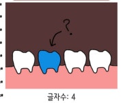 그림넌센스3 | 메이플 인벤