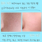 김다혜(nnyy6)님의 스타일       | 완전 건성에 피지와 각질 부각 심했던 내가 쓴 기초 두개 추천기초에 정착하지 못하고 여러개 써봤는데 제일   
