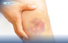 phòng khám chấn thương thể thao - velog