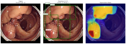 #오즈코딩스쿨 AI 헬스케어 52일차 #오즈코딩스쿨 AI 헬스케어 52일차
