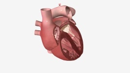 난원개존공은 심장의 두 상부 방, 즉 심방 사이의 벽에 존재하는 비정상적인 구멍입니다. 무비클립, 동영상, 영상,HD 영상, HD 비디오, HD... 