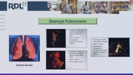 Nr 34 Trabalho a Quente(6)Doenças Pulmonares 제작 ROSSANO DUARTE LOBO on Prezi Video Nr 34 Trabalho a Quente(6)Doenças Pulmonares