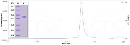 Chemokine family proteins | 연구용제품 > Bio마켓 | BRIC