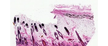 조직학 및 전체 유기체 이미징 | 애질런트