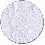PD-L1 IHC 28-8 pharmDx for Autostainer Link 48 | 애질런트
