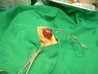 협회구조길냥이 - 비티님 구조/ 피눈물을 흘리고 있던, 안구적출 수술한 뮤뮤입니다 [목동하니병원]