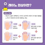 건강매거진 > 건강정보 > 가톨릭대학교 서울성모병원