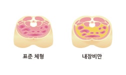 가톨릭대학교 여의도성모병원