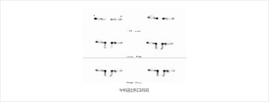 검사정보 : 전남대학교병원