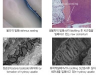 [Showcase]‘Ortho MTA’ & ‘Retro MTA’ - 덴탈아리랑 [Showcase]‘Ortho MTA’ & ‘Retro MTA’