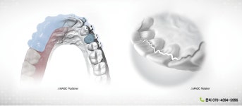 [2017 교정학회] 오스템임플란트, 디지털 교정 토탈솔루션 MAGIC Line - 덴탈아리랑 [2017 교정학회] 오스템임플란트, 디지털 교정... 