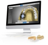 디오코, ‘Autolign’ 인기몰이 - 덴탈아리랑 디오코, ‘Autolign’ 인기몰이