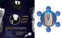 [덴탈세일페스타] 아이디덴탈, 디지털 세멘리스 크라운 Stable Line - 덴탈아리랑 [덴탈세일페스타] 아이디덴탈, 디지털 세멘리스... 