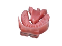 [비즈니스 리포트] 디지털 덴쳐 기술은 어디까지 왔는가 - 덴탈아리랑 [비즈니스 리포트] 디지털 덴쳐 기술은 어디까지 왔는가