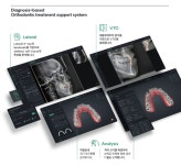 라온메디, Align Studio FDA 승인···미국 투명교정 시장 공략... 덴탈아리랑 라온메디, Align Studio FDA 승인···미국 투명교정 시장... 