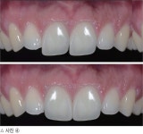 [창간특집 시그니처] VISION BIOCARE | 조상호 원장의... 시그니처] VISION BIOCARE | 조상호 원장의 ‘Signet Transparent Matrix... 