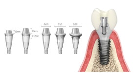 [쇼케이스] 덴티스 ‘Safe-Fit’, 빠르고 안전한 보철 치료 위한... 덴티스 ‘Safe-Fit’, 빠르고 안전한 보철 치료 위한 완벽한 솔루션