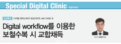 Digital workflow를 이용한 보철수복 시 교합채득 - 덴탈아리랑 [DASS 임상특강] 8. Digital workflow를 이용한 보철수복 시 교합채득