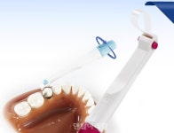 메디컴, 매트릭스 밴스 ‘SafeMatrix’ 출시 - 덴탈아리랑 메디컴, 매트릭스 밴스 ‘SafeMatrix’ 출시