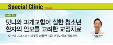 고려한 교정치료 - 덴탈아리랑 최광효 원장의 덧니와 과개교합이 심한 청소년 환자의 안모를 고려한 교정치료