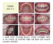 최광효 원장의 덧니와 과개교합이 심한 청소년 환자의 안모를 고려한 교정치료 - 덴탈아리랑 최광효 원장의 덧니와 과개교합이 심한 청소년... 
