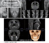 [오경아 원장의 임상스토리] Aesthetic vs Function-TMJ와 교합이 생각보다 중요한 이유 Ⅱ - 덴탈아리랑 [오경아 원장의... 