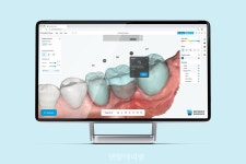 이마고웍스, Dentbird Crown & Batch 대규모 업데이트 - 덴탈아리랑 이마고웍스, Dentbird Crown & Batch 대규모 업데이트