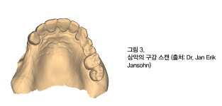 [임상증례] 치과와 기공소간 안정적 인터페이스에 기반한 exocad 솔루션 임상 - 덴탈아리랑 [임상증례] 치과와 기공소간 안정적... 