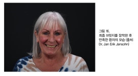 [임상증례] 치과와 기공소간 안정적 인터페이스에 기반한 exocad 솔루션 임상 - 덴탈아리랑 [임상증례] 치과와 기공소간 안정적... 