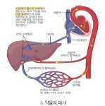 김영진 박사의 노인환자의 치과수술시 주의사항과 안전한 약물요법 5 - 덴탈아리랑 김영진 박사의 노인환자의 치과수술시 주의사항과 안전한... 