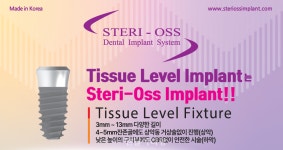 스테리오스임플란트, 티슈레벨 임플란트로 특별 프로모션 실시! - 덴탈아리랑 스테리오스임플란트, 티슈레벨 임플란트로 특별 프로모션 실시!