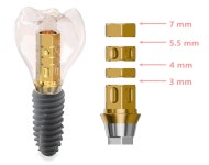 [KAOMI] 임플란트 연금술 ⑨ Cementless system을 이용한 난감한 상황에서의 효율적인 임플란트 보철 제작 - 덴탈아리랑 [KAOMI]... 