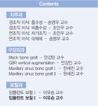 ⑩ Cementless system, 어떻게 선택할 것인가? - 덴탈아리랑 [KAOMI] 임플란트 연금술 ⑩ Cementless system, 어떻게 선택할 것인가?