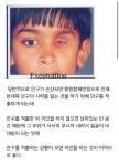 사진주의)의안은 심미적 용도 뿐이다? Fact check - DogDrip.Net 개드립