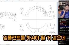 집앞 치과에서 한건데 신경치료 아무데서나 했냐고 혼난 침착맨 - DogDrip.Net 개드립