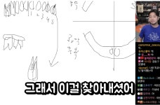 집앞 치과에서 한건데 신경치료 아무데서나 했냐고 혼난 침착맨 - DogDrip.Net 개드립