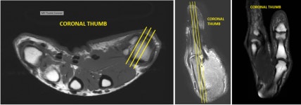 본인 방사선사인데 Mri 찍을때 매일 듣는 말이 있음 - DogDrip.Net 개드립