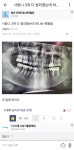 으악으악 사랑니 갤러리.jpg - DogDrip.Net 개드립