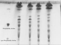 TLC에서 Phospholipid 분리할 때 생기는 밴드 끌림현상 | 실험 Q&A > 커뮤니티 | BRIC TLC에서 Phospholipid 분리할 때 생기는 밴드... 