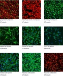 (주)성우라이프사이언스 Innoprot-Human Primary cell 제품들을 소개 합니다. | 연구용제품 > Bio마켓 | BRIC