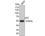 [HUABIO 한국대리점] p53 Mouse Monoclonal Antibody [6B5] (EM1701... 한국대리점] p53 Mouse Monoclonal Antibody [6B5] (EM1701-92)... 