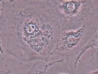 셀 사진즘 봐주세요ㅠ.ㅠ | 실험 Q&A > 커뮤니티 | BRIC