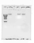 Agarose gel 전기영동 | 실험 Q&A > 커뮤니티 | BRIC