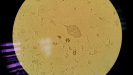 혹시 이런 cell본적있나요? | 실험 Q&A > 커뮤니티 | BRIC