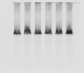 western blot band 끌림현상 | 실험 Q&A > 커뮤니티 | BRIC