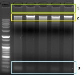 Human genomic DNA를 전기영동(Gel-Electrophoresis) 내렸는데 일정한 두께가 안나옵니다. | 실험 Q&A > 커뮤니티 | BRIC