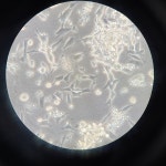 셀 컨탐 같은데 뭔지 알 수 있을까요? | 실험 Q&A > 커뮤니티 | BRIC